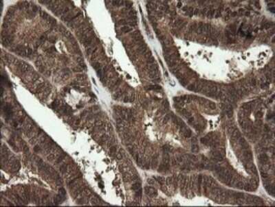 Immunohistochemistry: RhoJ Antibody (OTI1D7) - Azide and BSA Free [NBP2-73892]