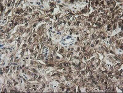 Immunohistochemistry: RhoJ Antibody (OTI1D7) - Azide and BSA Free [NBP2-73892]