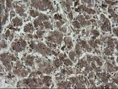 Immunohistochemistry: RhoJ Antibody (OTI1D7) - Azide and BSA Free [NBP2-73892]