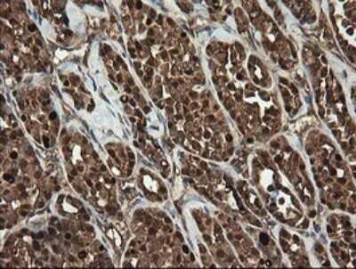 Immunohistochemistry: RhoJ Antibody (OTI1D7) - Azide and BSA Free [NBP2-73892]