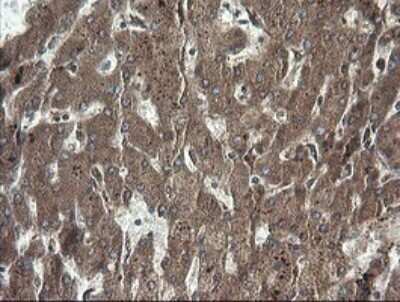 Immunohistochemistry: RhoJ Antibody (OTI1D7) - Azide and BSA Free [NBP2-73892]