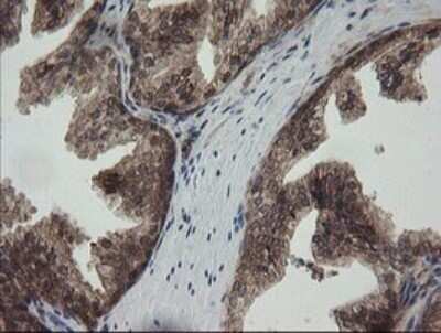 Immunohistochemistry: RhoJ Antibody (OTI1D7) - Azide and BSA Free [NBP2-73892]