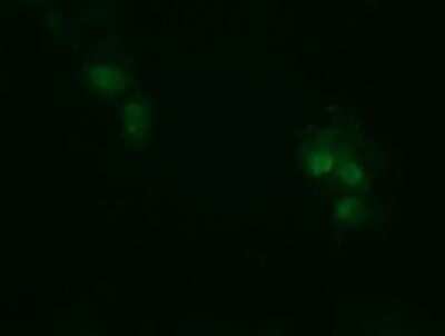 Immunocytochemistry/ Immunofluorescence: RhoJ Antibody (OTI1D7) [NBP2-45590]