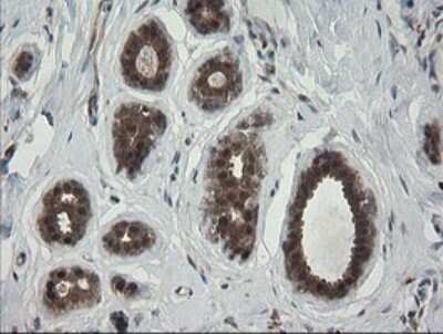 Immunohistochemistry: RhoJ Antibody (OTI1D7) [NBP2-45590]