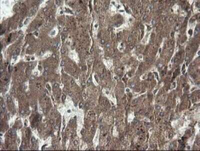Immunohistochemistry: RhoJ Antibody (OTI1D7) [NBP2-45590]