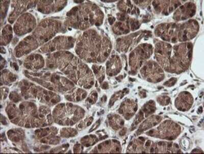 Immunohistochemistry: RhoJ Antibody (OTI1D7) [NBP2-45590]