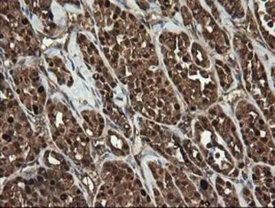 Immunohistochemistry: RhoJ Antibody (OTI1D7) [NBP2-45590]