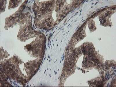 Immunohistochemistry: RhoJ Antibody (OTI1D7) [NBP2-45590]