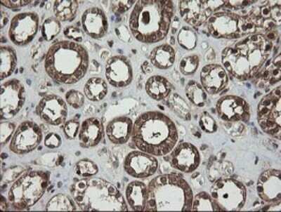 Immunohistochemistry: RhoJ Antibody (OTI1D7) [NBP2-45590]