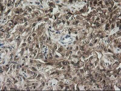 Immunohistochemistry: RhoJ Antibody (OTI1D7) [NBP2-45590]