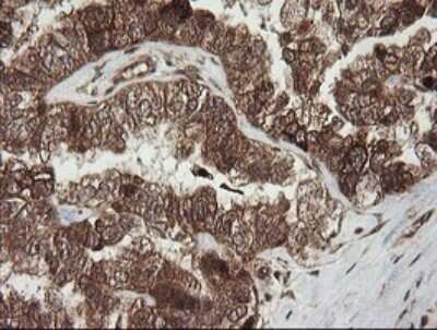 Immunohistochemistry: RhoJ Antibody (OTI1D7) [NBP2-45590]