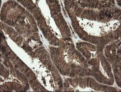 Immunohistochemistry: RhoJ Antibody (OTI1D7) [NBP2-45590]