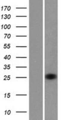 Western Blot: RhoV Overexpression Lysate [NBP2-05695]