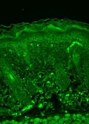 Immunohistochemistry: Rhodopsin Antibody (1D4) [NBP1-47602]