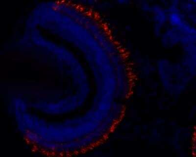 Immunohistochemistry-Frozen: Rhodopsin Antibody (4D2) [NBP2-59690]