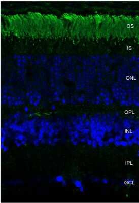 Immunohistochemistry: Rhodopsin Antibody (4D2) [NBP2-59690]