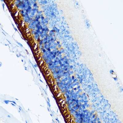 Immunohistochemistry-Paraffin: Rhodopsin Antibody (5N3G9) [NBP3-16655]