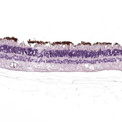 Immunohistochemistry-Paraffin: Rhodopsin Antibody [NBP2-55553]
