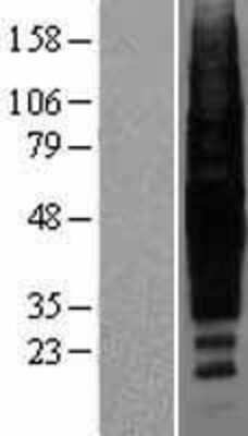Western Blot: Rhodopsin Overexpression Lysate [NBP2-04162]