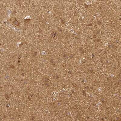 Immunohistochemistry-Paraffin: Rhot1 Antibody (CL1083) [NBP2-52964]