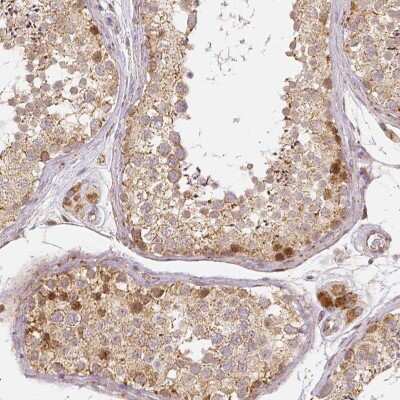 Immunohistochemistry-Paraffin: Rhot1 Antibody (CL1083) [NBP2-52964]