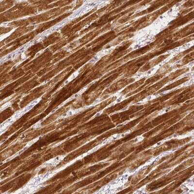 Immunohistochemistry-Paraffin: Rhot1 Antibody (CL1083) [NBP2-52964]