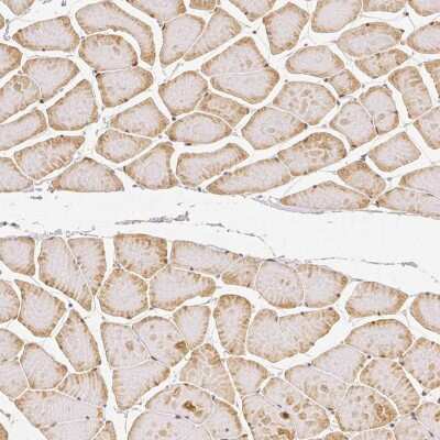 Immunohistochemistry-Paraffin: Rhot1 Antibody (CL1083) [NBP2-52964]