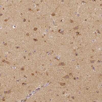 Immunohistochemistry-Paraffin: Rhot1 Antibody (CL1095) [NBP2-52965]