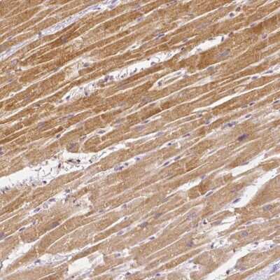 Immunohistochemistry-Paraffin: Rhot1 Antibody (CL1095) [NBP2-52965]