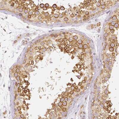 Immunohistochemistry-Paraffin: Rhot1 Antibody (CL1095) [NBP2-52965]