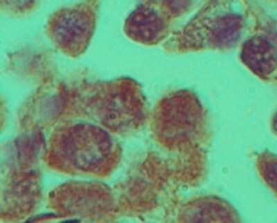 Immunohistochemistry-Paraffin: Rhox11 Antibody [NBP2-23830]