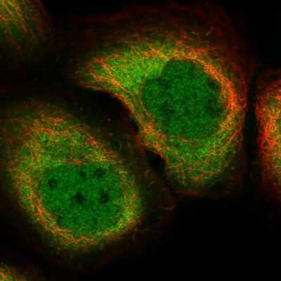 Immunocytochemistry/ Immunofluorescence: Ribonuclease Inhibitor Antibody [NBP1-87161]