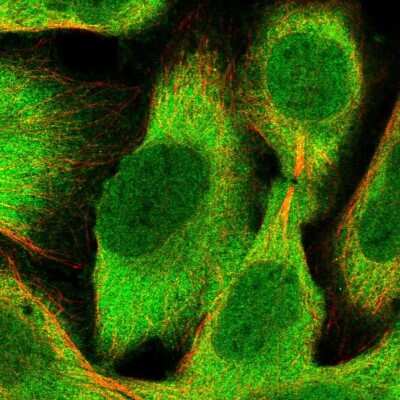 Immunocytochemistry/ Immunofluorescence: Ribonuclease Inhibitor Antibody [NBP1-87162]