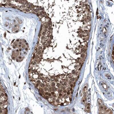 Immunohistochemistry-Paraffin: Ribonuclease Inhibitor Antibody [NBP1-87162]