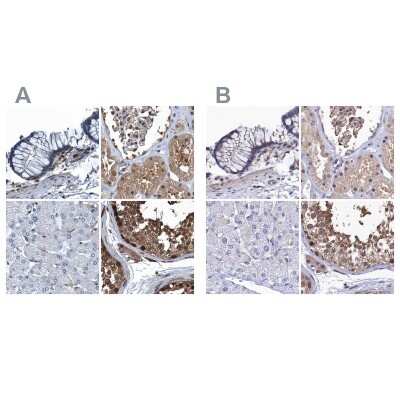 Immunohistochemistry-Paraffin: Ribonuclease Inhibitor Antibody [NBP1-87162]
