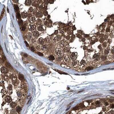 Immunohistochemistry-Paraffin: Ribonuclease Inhibitor Antibody [NBP1-87162]