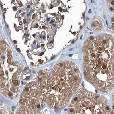 Immunohistochemistry-Paraffin: Ribonuclease Inhibitor Antibody [NBP1-87162]