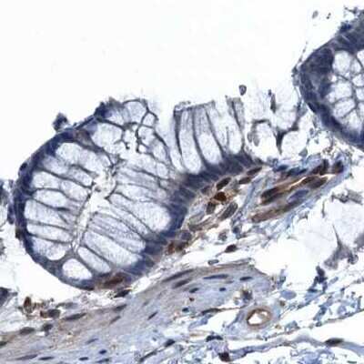 Immunohistochemistry-Paraffin: Ribonuclease Inhibitor Antibody [NBP1-87162]
