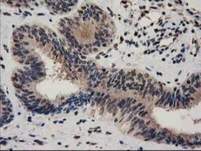 Immunohistochemistry: Ribonuclease Inhibitor Antibody (OTI1B7) - Azide and BSA Free [NBP2-73896]