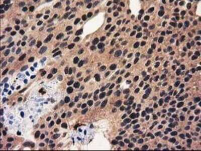 Immunohistochemistry: Ribonuclease Inhibitor Antibody (OTI1B7) - Azide and BSA Free [NBP2-73896]