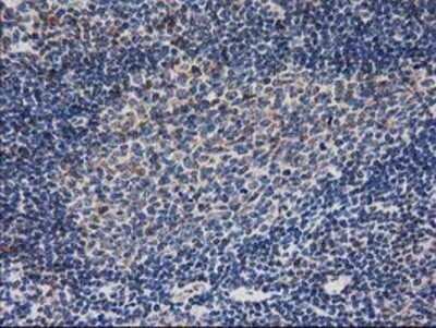 Immunohistochemistry: Ribonuclease Inhibitor Antibody (OTI1B7) - Azide and BSA Free [NBP2-73896]