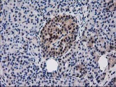Immunohistochemistry: Ribonuclease Inhibitor Antibody (OTI1B7) - Azide and BSA Free [NBP2-73896]