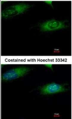 Immunocytochemistry/ Immunofluorescence: Ribophorin I Antibody [NBP1-32704]