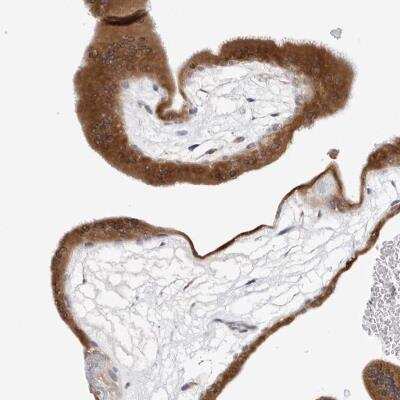 Immunohistochemistry: Ribophorin I Antibody [NBP1-82467]