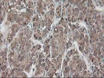Immunohistochemistry: Ribophorin I Antibody (OTI3H3) - Azide and BSA Free [NBP2-73898]