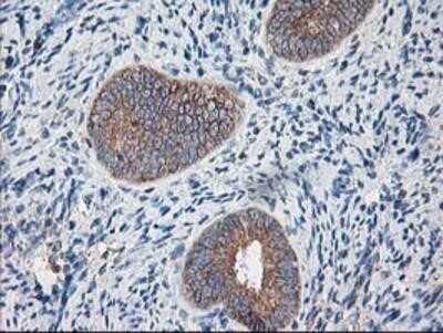 Immunohistochemistry: Ribophorin I Antibody (OTI3H3) - Azide and BSA Free [NBP2-73898]