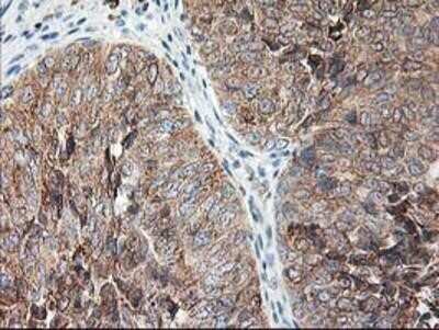 Immunohistochemistry-Paraffin: Ribophorin I Antibody (OTI3H3) [NBP2-01294]