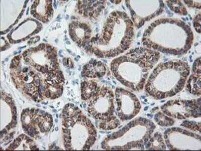 Immunohistochemistry-Paraffin: Ribophorin I Antibody (OTI3H3) [NBP2-01294]