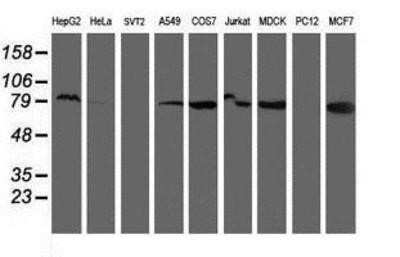 Western Blot: Ribophorin I Antibody (OTI3H3) [NBP2-01294]