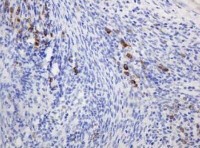 Immunohistochemistry: Ribophorin II Antibody (OTI1G9) [NBP2-45963]